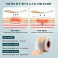 thumbnail image 4 of Soft Silicone Scar Tape Roll for Keloid and Surgical Scar Care, 0.8" x 39.4" Size, 4 of 5
