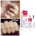 thumbnail image 3 of Tratamiento de esmalte de uñas Mavala Stop Deterrent de 9 ml durante más de 3 años, 3 of 7