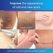 Scaraway 100% Silicone Scar Gel .35 oz