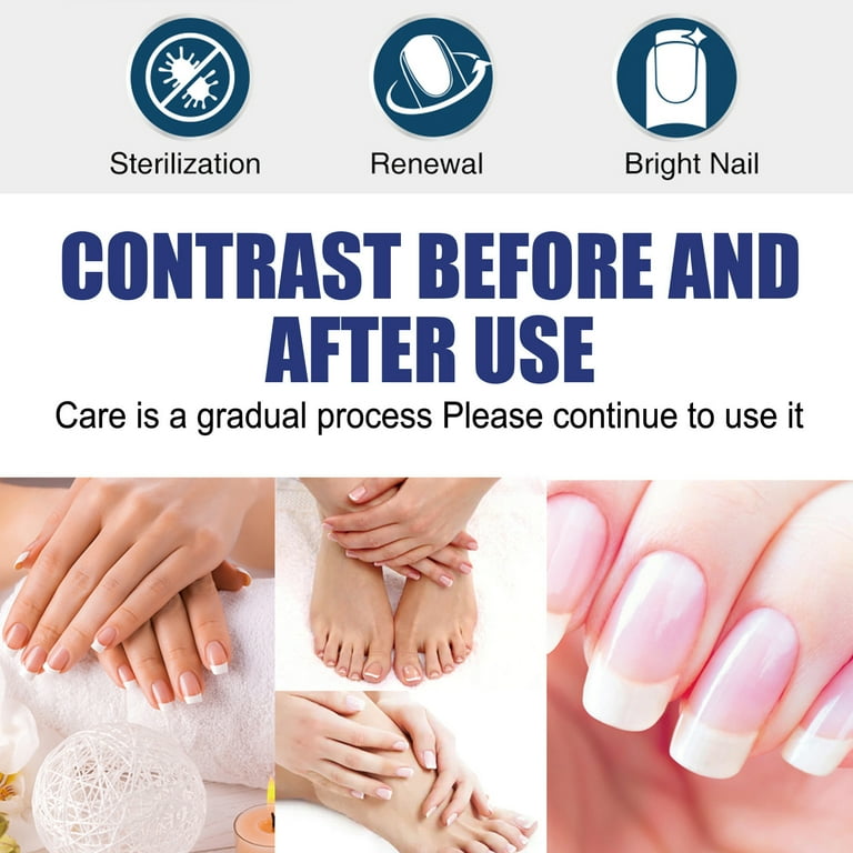3 Pack Fungal Nail and Toenails Maximum Strength Antifungal Liquid with Built in Brush
