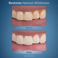 thumbnail image 5 of Tabletas de recarga Waterpik Fresh Mint Whitening (30 unidades), 5 of 5