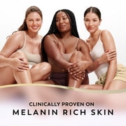 Olay Body Lotion, Dark Spot Correcting with AHA, Vitamin C and Niacinamide, 17 fl oz