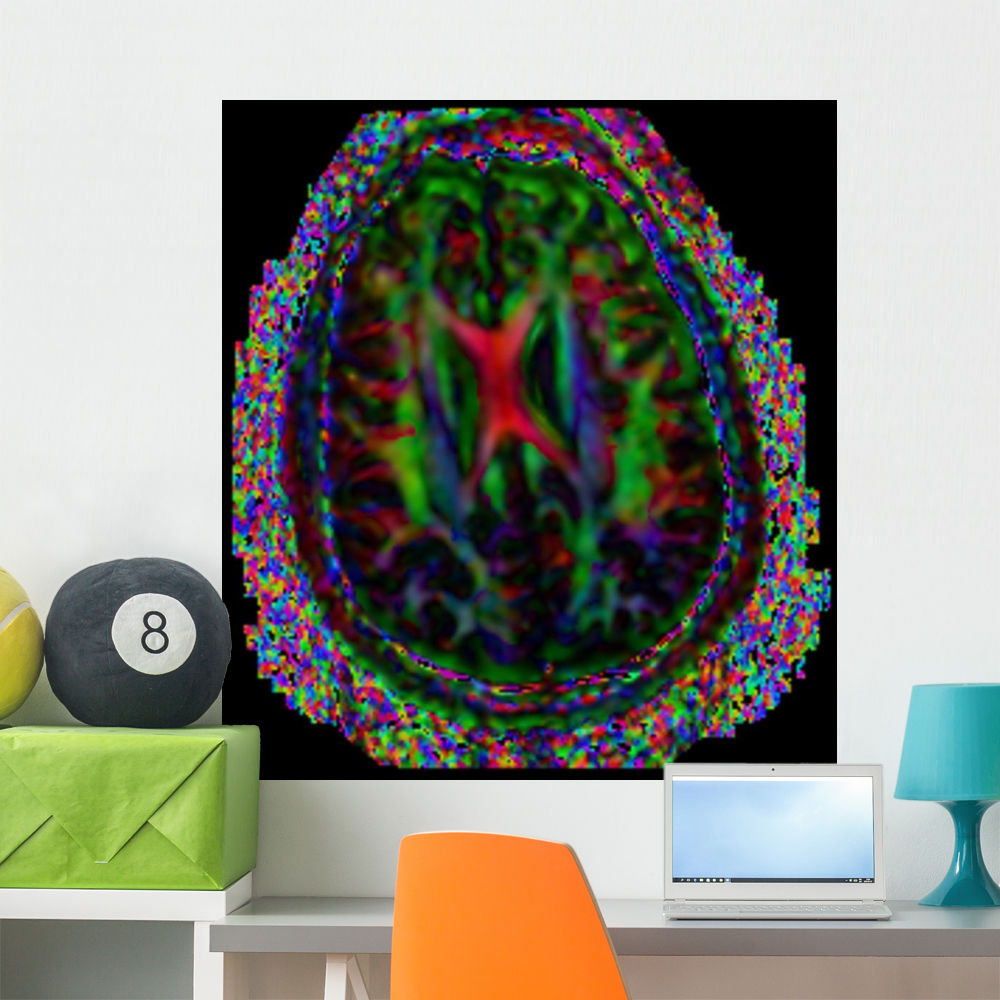 Brain Mri Wall Mural by Wallmonkeys Peel and Stick Graphic (36 in H x ...