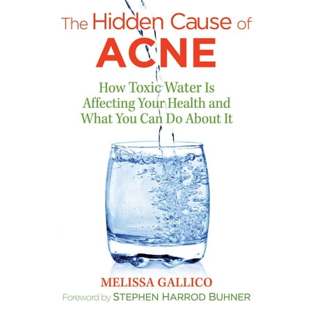 The Hidden Cause of Acne : How Toxic Water Is Affecting Your Health and What You Can Do about It