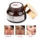 thumbnail image 2 of Crema para Las Pecas, Quitar Las Pecas Crema para Dark Spot Cream Punto Oscuro Melanina Crema Tizo For Hidratante Blanqueadora Ecomeon no, 2 of 6