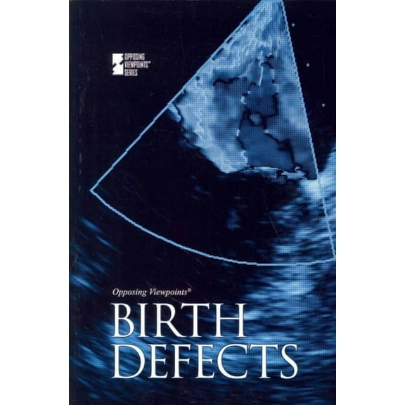 Birth Defects Opposing Viewpoints Paperback 0737745053 9780737745054 Noel Merino