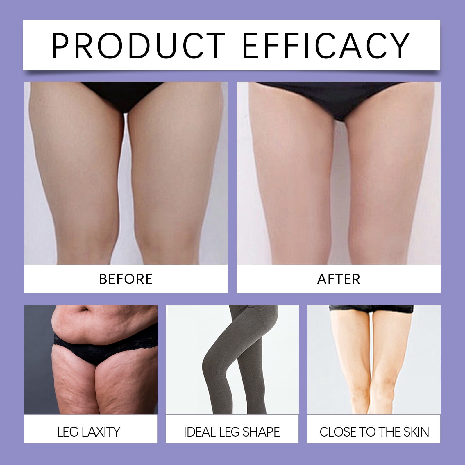 Alvantor Thigh Lift Tape, Anti Cellulite Thigh Tightening Tape Invisible Firming, 10pcs