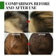 thumbnail image 5 of 2Pcs Aceite para el cabello de romero de 30ml, nutritivo para el cuero cabelludo, estimula el crecimiento del cabello, aceite para el cuidado del cabello, champú para el crecimiento del cabello, 5 of 5