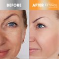 thumbnail image 4 of Hidratante facial con retinol y vitamina C, 4 of 6