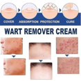 thumbnail image 5 of 3pcs Pinghouyou Wart Removing Ointment 20g, 5 of 5