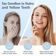 thumbnail image 5 of Professional Teeth Whitening Strips Non-Sensitive Mint Flavor Teeth Whitening Kit Advanced 3D Teeth Whitener Strips Tooth Whitening, 5 of 5