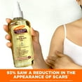 thumbnail image 5 of (6 pack) Palmer's Cocoa Butter Formula Skin Therapy Oil for Dry Skin, 5.1 fl. oz., 5 of 20