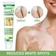 thumbnail image 1 of Crema de tratamiento White Tag para reducir las manchas blancas de la piel y el cuidado de la piel con vitíligo. Afortunado Sencillez, 1 of 4