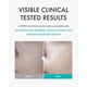 thumbnail image 3 of Mascarilla REJURAN Turnover Mask C-pDRN Skin Repair 40 ml x 5, 3 of 7
