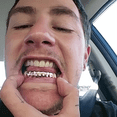 thumbnail image 2 of 14k Rose Gold Plated Grillz Bottom Lower Teeth Plain Six Tooth Hip Hop Grills, 2 of 3