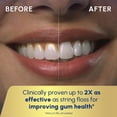 thumbnail image 6 of Waterpik Cordless Plus 5000 Water Flosser with 2 Settings, 3 Tips, ADA Accepted, Black, 6 of 16