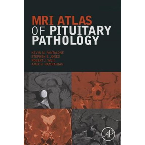 Pre-Owned MRI Atlas of Pituitary Pathology, (Hardcover)