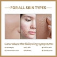 thumbnail image 4 of Tónico facial de arroz Hidratación profunda Alivio del enrojecimiento Cuidado iluminador de la piel NUEVO, 4 of 5