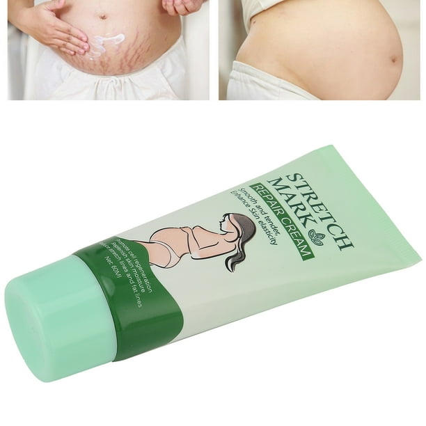 Crème Vergetures Maternité Et Réparation Cicatrices – 100ml, à L'acide Glycolique, Beurre De Karité, Bio, Sans Colorants