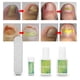thumbnail image 1 of Juego De Herramientas De Pedicura Profesional Para Uñas, Recortador De Uñas Encarnadas, Fijador De Corrección Para El Cuidado De Los Pies, 1 of 7