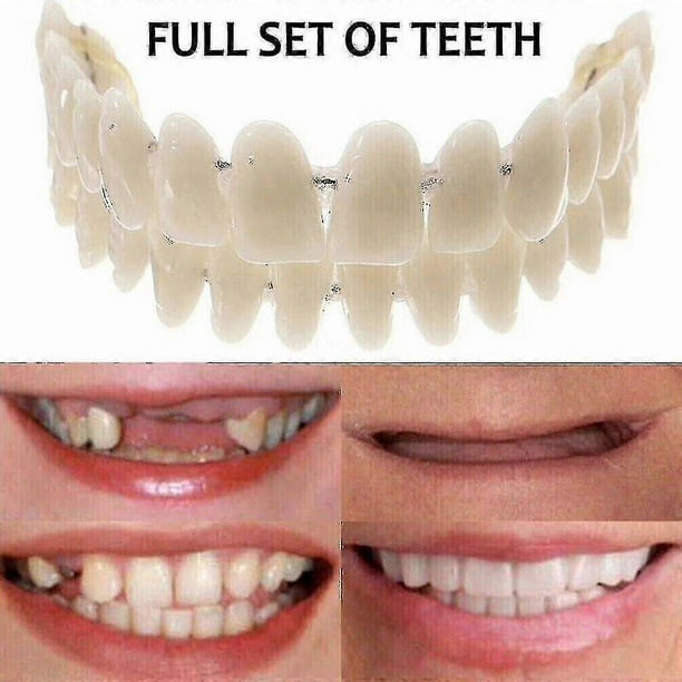 Yougang Boutique Smile Snap On False Teeth Upper Lower Dental Veneers Dentures Tooth Cover Set-dwdz