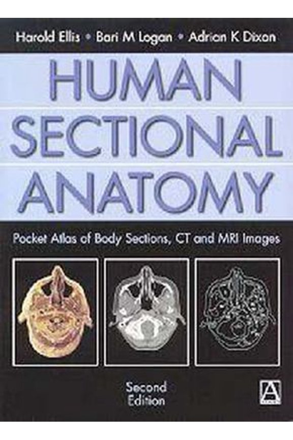 Pre-Owned Human Sectional Anatomy : Pocket Atlas of Body Sections, CT and MRI Images (Paperback) 9780340807644
