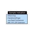 thumbnail image 4 of ComfySplints™ Spring Loaded Goniometer Hand Orthosis, Adult, 4 of 6