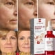thumbnail image 5 of Suero facial reafirmante instantáneo para el cuidado de la piel, líquido antienvejecimiento para eliminar arrugas, Retinol, líneas finas, blanqueamiento, productos coreanos, 5 of 5