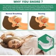 thumbnail image 2 of Lishi Adjustable Anti-Snoring Mouth Guard - Stop Snoring, Improve Sleep Quality, 2 of 5