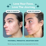 (3 pack) Proactiv Solution 3-Step Acne Treatment System, 30-Day Supply