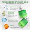 thumbnail image 2 of OUKEYA Niacinamide 10% Niacinamide +1% Zinc PCA Serum, 1.18 fl.oz (35ml), 2 of 9