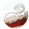 thumbnail image 3 of XIRQI Mouth Guard for Grinding and Clenching Teeth at Night Sleep Night Guard Grinding Protection Clenching Protection Teeth Bruxism Mouth Piece, 3 of 7