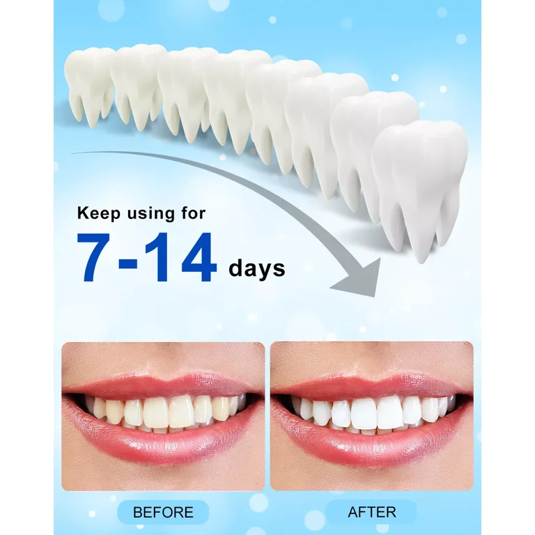 LED Teeth Whitening Light Accelerator With Gel photo 8