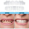 thumbnail image 5 of Dentaduras postizas de carilla instantánea Cosmético temporal Sonrisa dentada Frenos de superposición alta y baja Kit de reparación de blanqueamiento y alisado con mini pinzas, 5 of 5