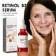 thumbnail image 4 of Essence Aging Retinol Face, suero antiarrugas con retinol B3, suero con vitamina B3 (30 ml), suero de belleza facial antiedad con humectante (30 ml), 4 of 9