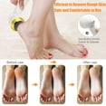 thumbnail image 5 of Electric Foot Callus Remover with Vacuum for Powerful Pedi Feet Care Vac, Best for Hard, Dry, Cracked, Dead Skin, 5 of 8