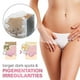 thumbnail image 4 of Whitening Cream, Intimate Area Skin Lightening Cream, Skin Bleaching Cream, Dark Spot Corrector Cream For Inner Thigh, 4 of 5