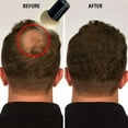 thumbnail image 6 of KERATIN RESEARCH Hairline Filler Unisex Mineral Powder Root Touch-Up Hair loss Concealer Scalp & Beard Bald Patch Coverage Fibers for Thinning Hair Waterproof Organic Natural look (MEDIUM BROWN, XL), 6 of 10