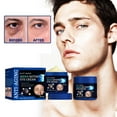 Fine Dryness Skin And Lotion Aging Tighten Men's Lines Reduces
