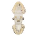 thumbnail image 5 of Modelo Patológico De Implante Dental, Modelo Patológico De Implante Dental Transparente Modelo De Dientes De Enfermedad De Implante Para Demostración De Enseñanza, 5 of 5