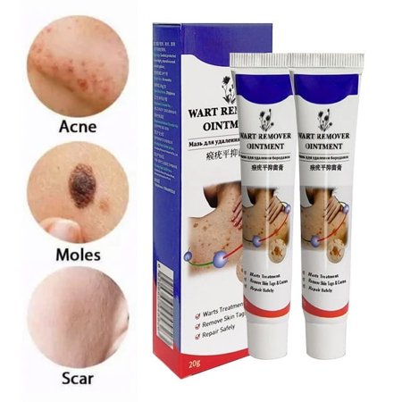 Tag Skin Removal Cream Skin Care Cream,Wart Removal Cream,Fast Acting,20G-2pcs