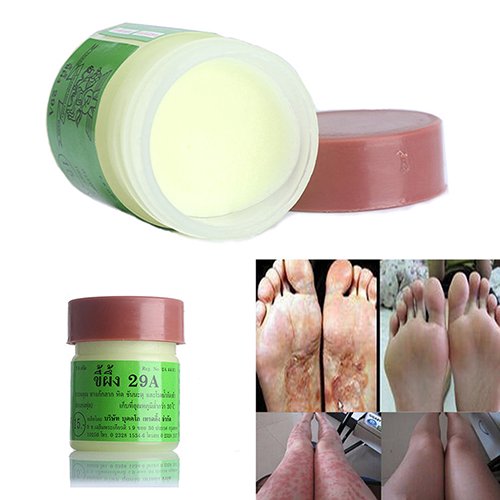 Ringworm Treatment Creams