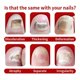 thumbnail image 5 of 2pcs Onychomycosis Rapid Relief Oil, Toenail Nail Treatment, Anti-Fungus Relief Oil, 5 of 5