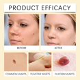 thumbnail image 3 of Clean Keyou Care Spray piel hidratante limpieza hidratante suave cuidado de la piel Spray 20ml, 3 of 4