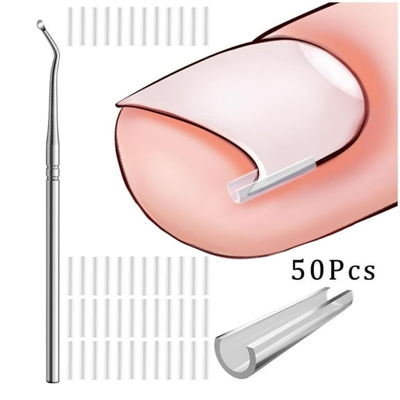 Tutuviw 50Pcs Ingrown Toenail Treatment Corrector with Toenail Lifter Ingrown Toenail Pedicure Recover Clips Toenails Thick Pedicure Tool for Men Women Foot Care