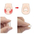thumbnail image 4 of Kuymtek Corrector Uñas Encarnadas Silicona 50 Uds. Corrector Cuidado Paroniquia 7 Tamaños, 4 of 9