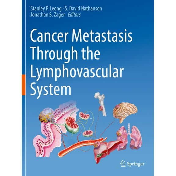 Cancer Metastasis Through the Lymphovascular System, (Paperback)