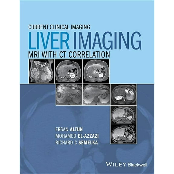 Current Clinical Imaging Liver Imaging: MRI with CT Correlation, Book 1, (Hardcover)