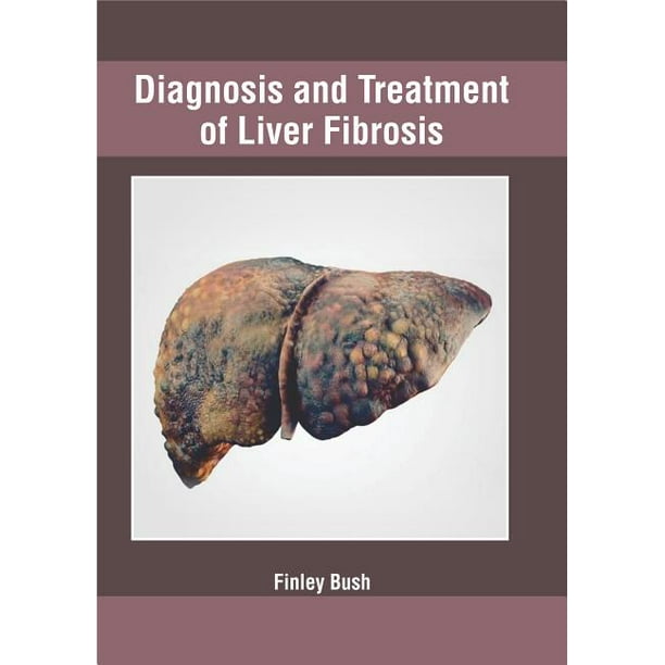 Diagnosis and Treatment of Liver Fibrosis (Hardcover)