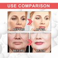 thumbnail image 5 of Collagen Boosting Anti-aging Serum for All Skin Types 30ml, 5 of 5